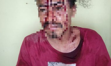 Hendak-Selesaikan-Masalah-Tawuran-Didesanya,-Brigpol-Salmun-Anggota-Polres-Kupang-ini-babak-belur-Dihajar--Sekelompok-Pemuda-Mabuk