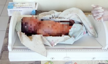 Diduga-Bunuh-Bayi-yang-Baru-Dilahirkan,-Seorang-Ibu-di-Amfoang-Timur-Diamankan-Polisi