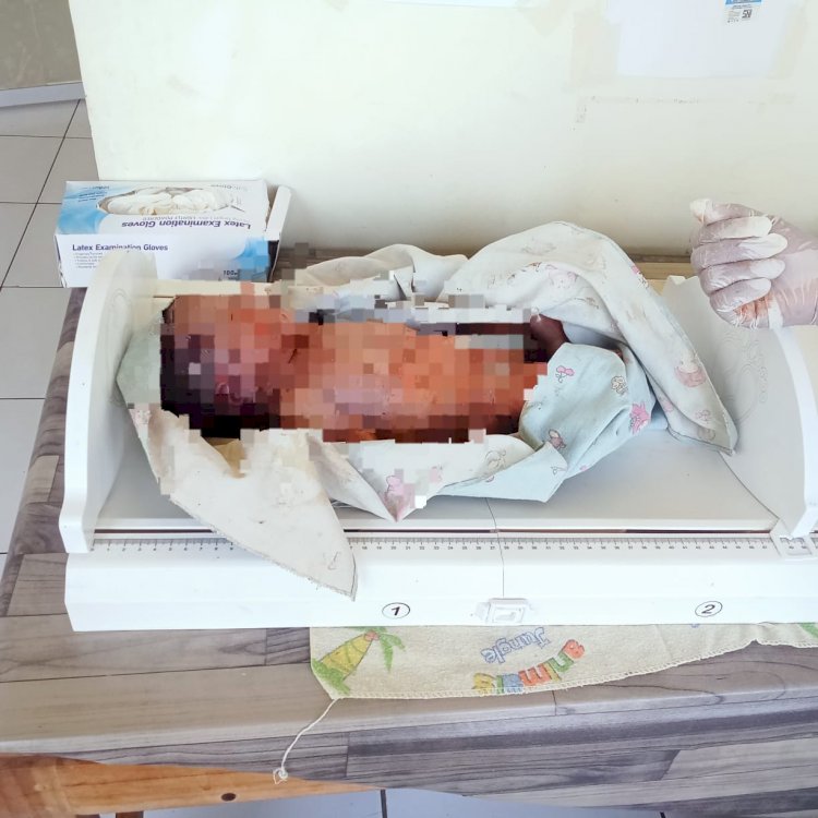 Diduga Bunuh Bayi yang Baru Dilahirkan, Seorang Ibu di Amfoang Timur Diamankan Polisi